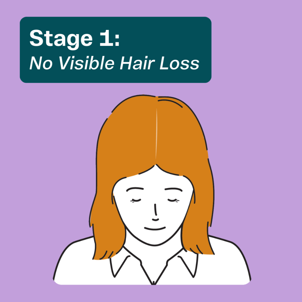 Treatments for early hair thinning in women