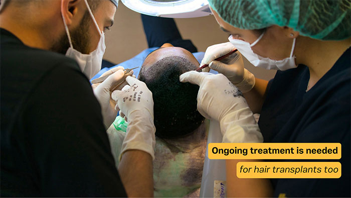 Hair transplant surgery