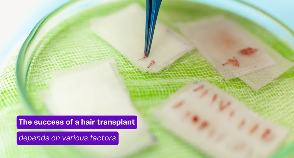 Hair transplant cost